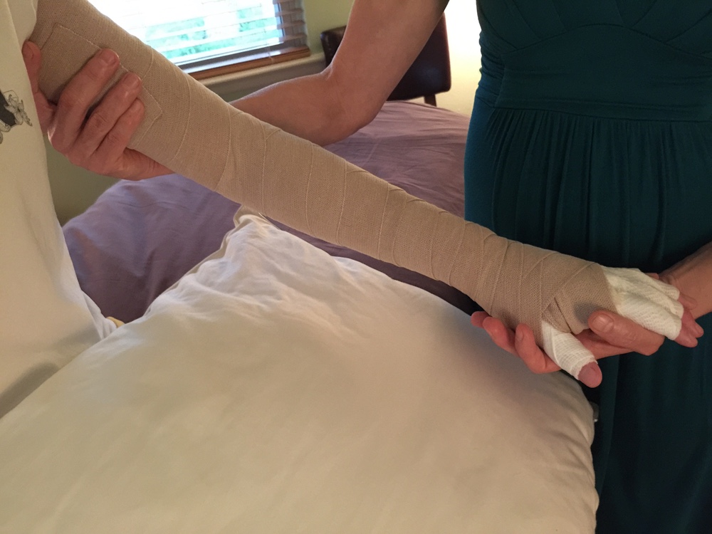 Arm bandaging for compression