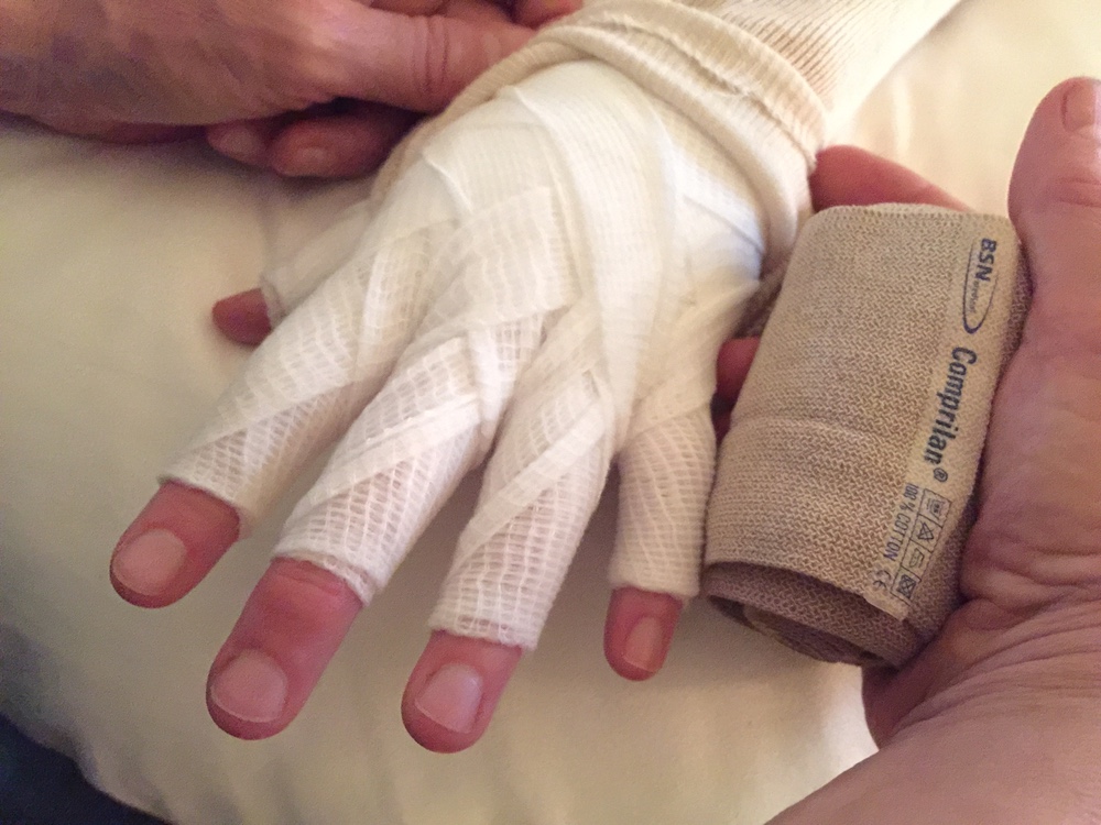 Hand bandaging for compression