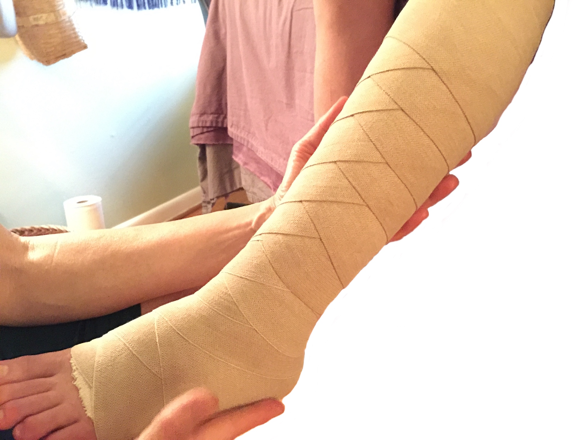 A healthy leg bandaged to demonstrate compression